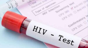HIV cases in Pakistan